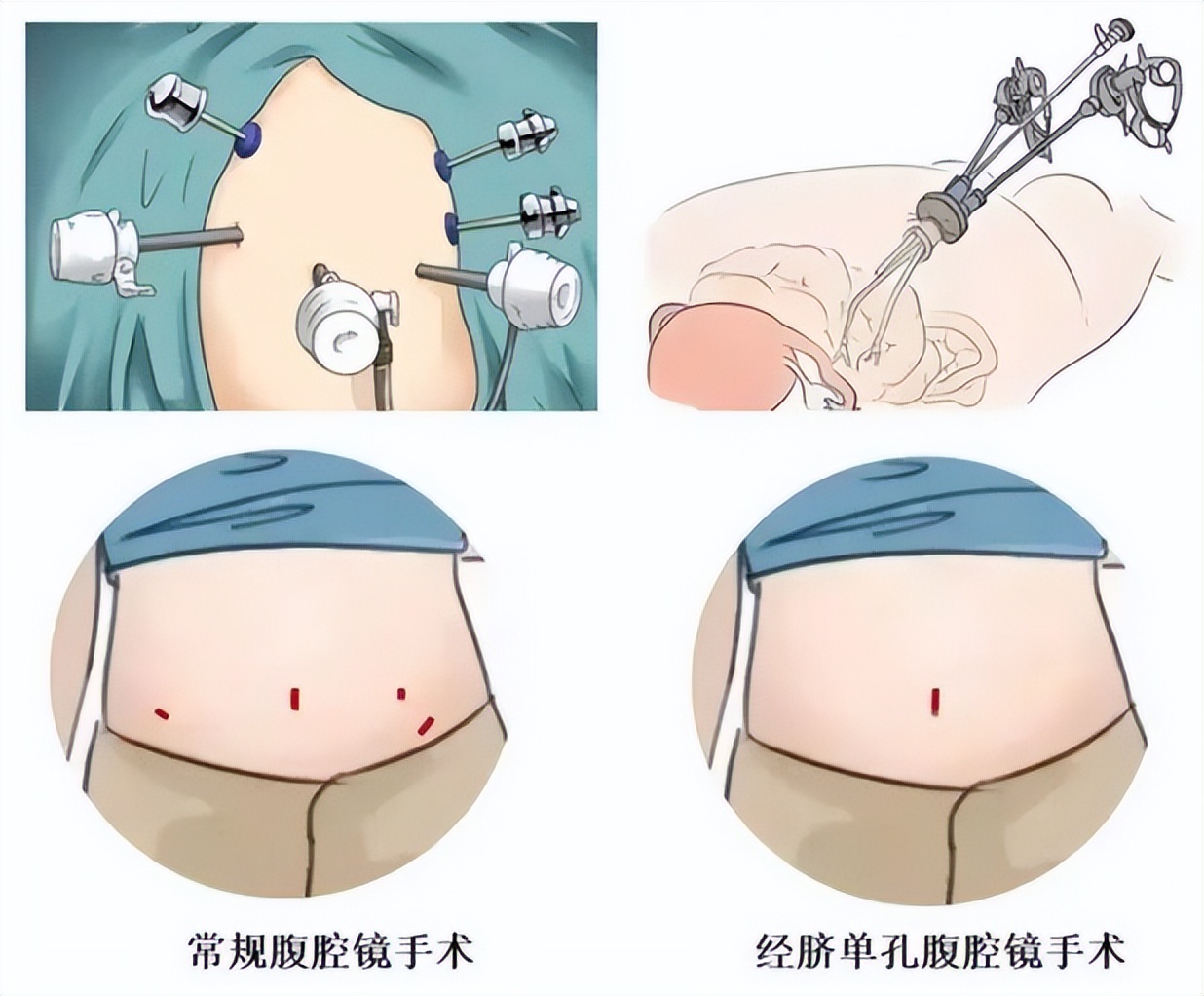 bf679219601048b8a29e23b689ad4b30_tplv-tt-origin-web_gif.jpeg