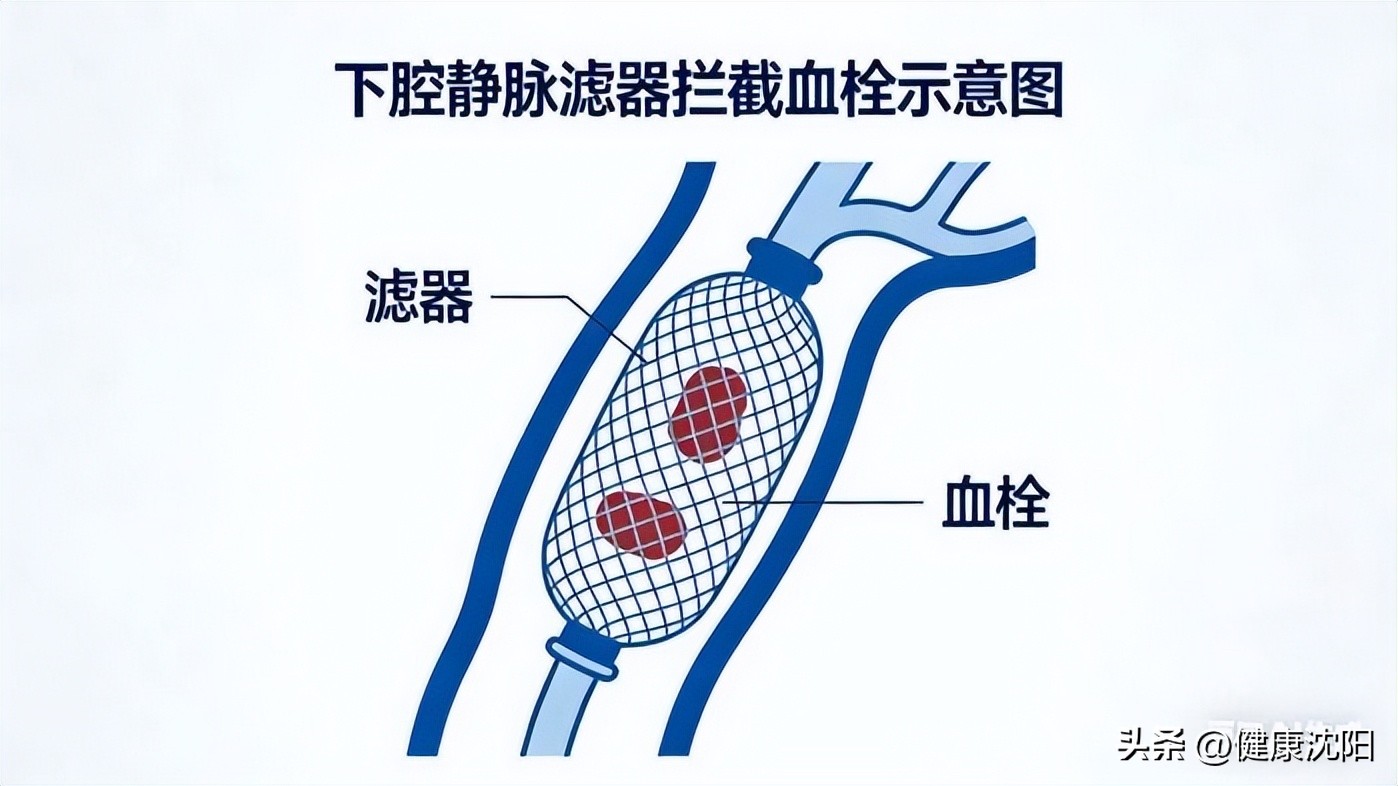 0a37a68916d04483aa6aa7a7cac087ae_tplv-tt-origin-web_gif.jpeg