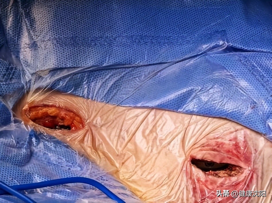 ab95a88adaa848dcb2d9d1c87a444d6a_tplv-tt-origin-web_gif.jpeg