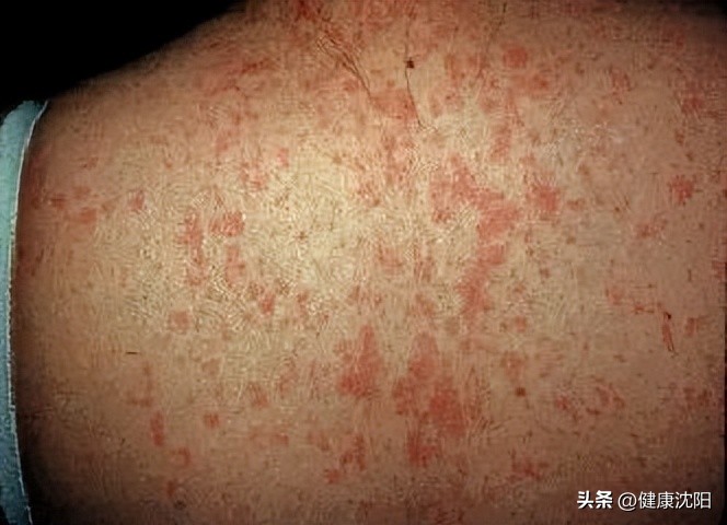 e81b192fedea4a9b86e7e07975fd4fc0_tplv-tt-origin-web_gif.jpeg