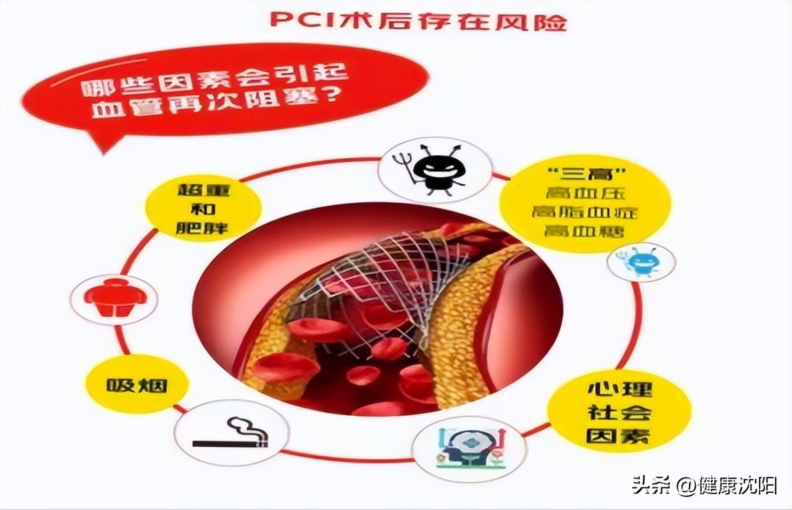 ad3ba5a7ff734b809b793c7fe2af82f9_tplv-tt-origin-web_gif.jpeg